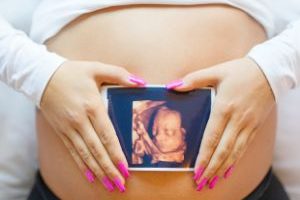Two Came True | What to expect from prenatal care in twin pregnancy